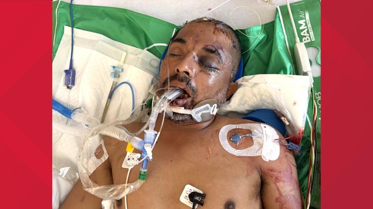 University Hospital asks for help identifying unconscious patient hit by truck Saturday evening — KENS 5 (San Antonio), Plymouth Health news