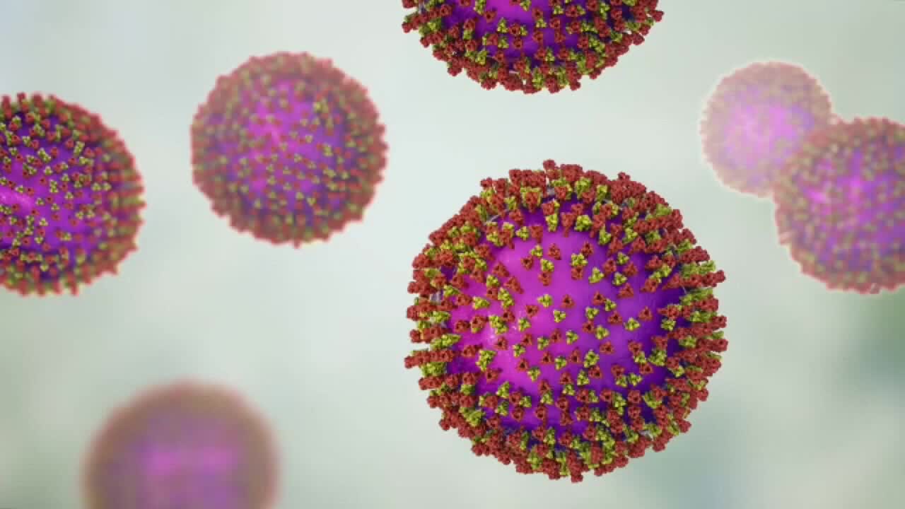 Wisconsin measles outbreak rises to 267 cases as spread continues — FOX 9, Plymouth Health news